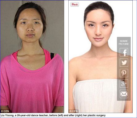 Chinese woman before and after Westernizing cosmetic surgery
